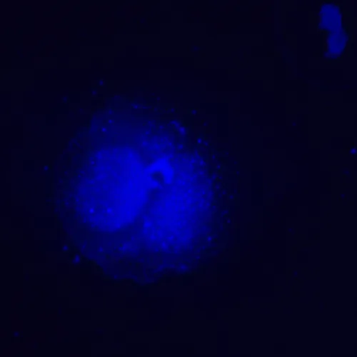 fotoğraf MAGUS Lum VD500L LCD Floresan İnverted Dijital Mikroskop,  25