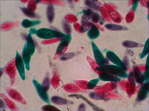 fotoğraf Levenhuk N38 NG Hazırlanmış Slayt Seti,  12