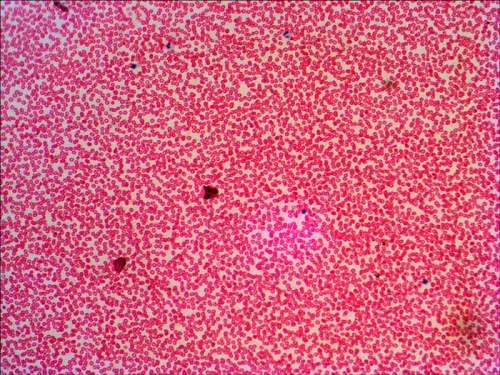 fotoğraf Levenhuk N38 NG Hazırlanmış Slayt Seti,  16